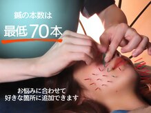 鍼灸チャンドラ(鍼灸Chandra)/30～40本では足りません