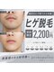 プリマプリート 大垣店の写真/★お肌に優しい最先端脱毛マシン導入★ヒゲ脱毛で清潔感UP&青ヒゲ卒業♪【脱毛(顔全体&パック付)¥2200】