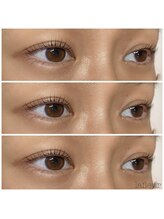 ラ フルール(La fleur)/