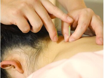 本厚木 リターナル(ReTurnal)/鍼/首肩こり