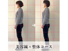 コトハリ/猫背・巻き肩の施術が得意♪