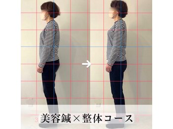 コトハリ/猫背・巻き肩の施術が得意♪