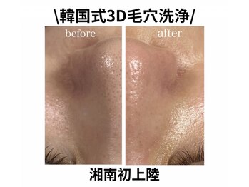 ネイルサロン きらら 藤沢本店の写真/【韓国式3D毛穴洗浄】もう“いちご鼻”で悩まない！黒ずみ・ざらつき・毛穴汚れをごっそり除去◎