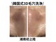 ネイルサロン きらら 藤沢本店の写真/【韓国式3D毛穴洗浄】もう“いちご鼻”で悩まない！黒ずみ・ざらつき・毛穴汚れをごっそり除去◎