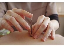 ミヅキビューティー(MIDUKI BEAUTY)/歴35年◎女性鍼灸師にお任せ