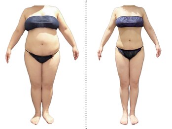 ベルミーランド イオンモール高崎の写真/【破格体験メニュー多数ご用意！】全身痩身90分★最新痩身器機使用で理想のあなたへ導きます！