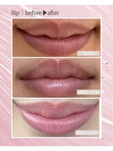 リュアン(Luan)/ローマピンク　唇