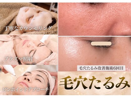 エー プラス リラボ(A plus Relab)の写真