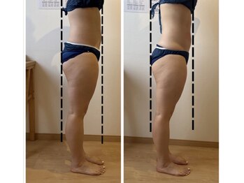Rety Body&Facialの写真/芯から温めて不調改善を目指す♪マシンWIINBACKで理想のボディラインを整える