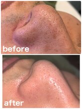 ビューティーアンドボディメイクBB シャオ西尾店/メンズフェイシャル☆