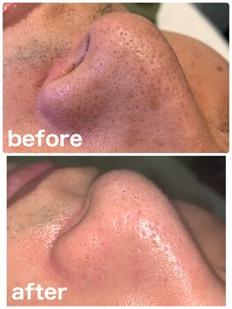 ビューティーアンドボディメイクBB シャオ西尾店/メンズフェイシャル☆