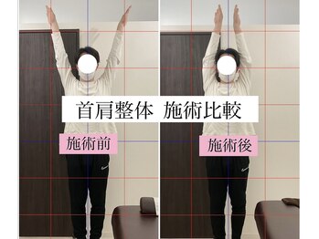 弁天町駅前整体院/首肩整体3回目の症例