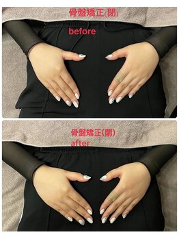 深層整筋サロン/骨盤矯正（20代）