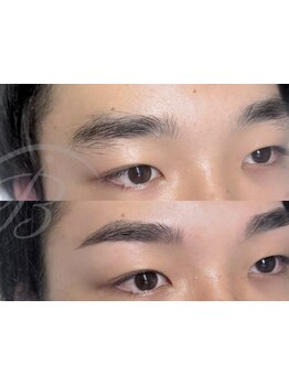 メンズフェイシャル