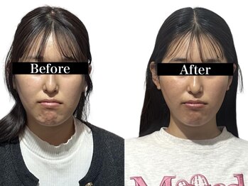 オアシス トウキョウ 心斎橋(OASIS TOKYO)/