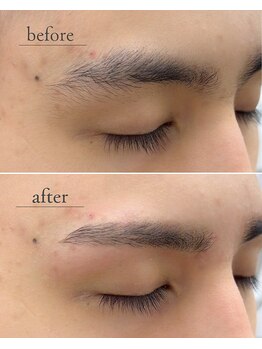 アモール 丸亀店(Amor)/眉毛/まつげパーマ/毛穴/脱毛