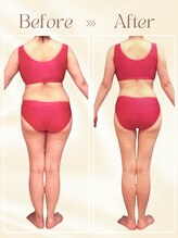 ピュアエステ ブリアント 新宿店&nbsp;40代 痩身結果