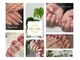 ハロネイル(Halo Nail)の写真