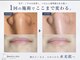ジュエリースキン(JewelrySkin)の写真