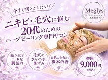メグリス(Meglys)
