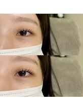 ヒールムーン(heal moon)/フラットマットラッシュ