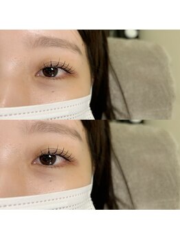 ヒールムーン(heal moon)/フラットマットラッシュ