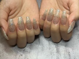 チップスカルプ[新宿三丁目］