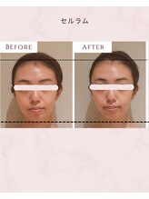 ウル(Uru)/セルラム60分