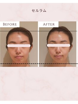 ウル(Uru)/セルラム60分