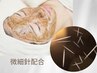 ★微細針配合★美白・ハリツヤケアハーブピーリング【剥離なし】