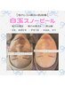 【白玉スノーピール】黒ずみ・ニキビ・毛穴ケアに最適◎理想の美白肌☆¥5980