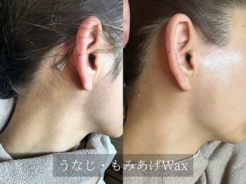 アルム(Arum)/フェイス＆もみあげ＆うなじWax