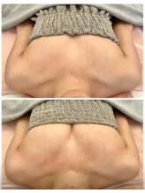 美人バスト 柏店/【バストアップ・育乳】症例