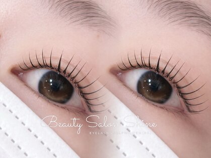 シャイン(Shine)の写真