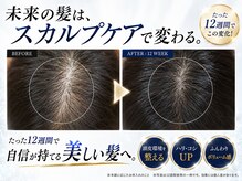 BLD/クリニカルスカルプケアB&A