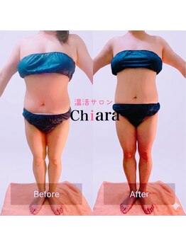 キアラ(Chiara)の写真/【痩せたいのに変われない大人女性へ】温めてほぐして引き締める全身痩身ケア♪首肩こり・姿勢のお悩みも◎