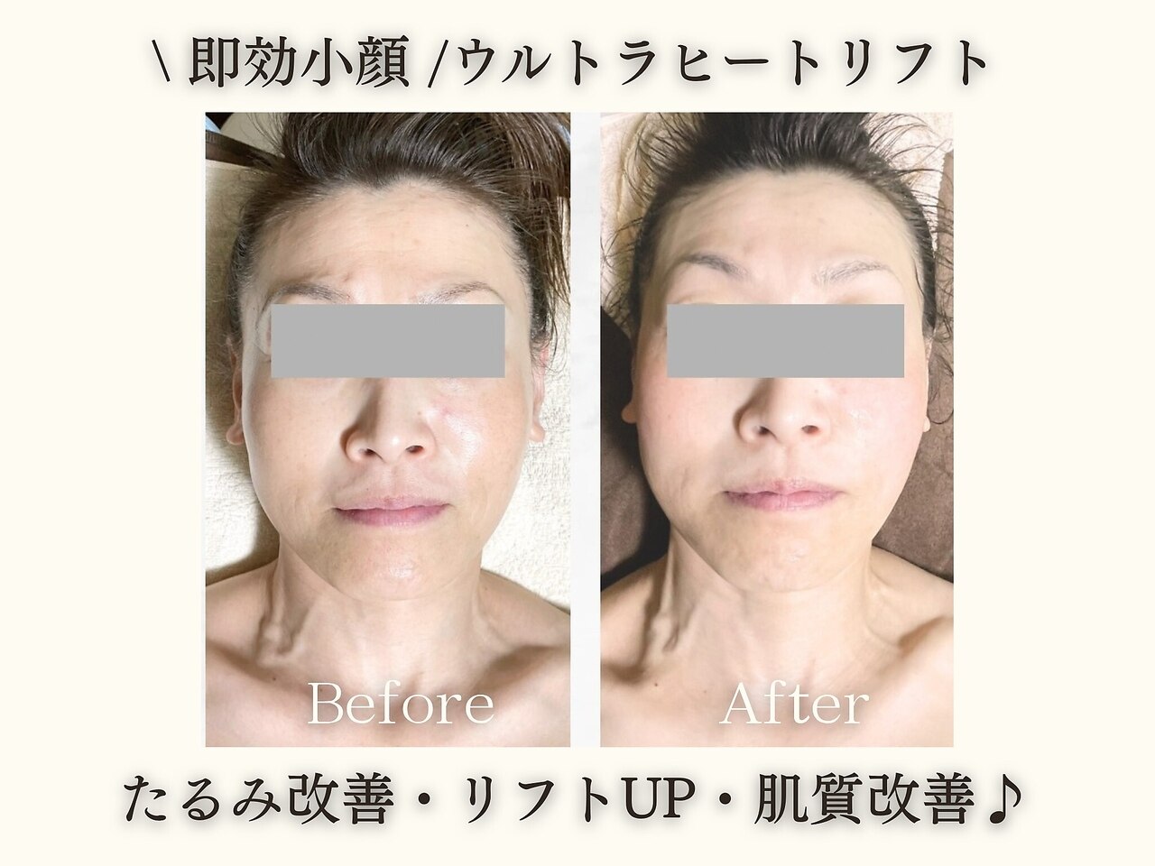 エステサロン JJシャンハイ｜ホットペッパービューティー