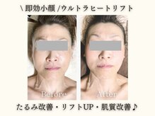エステサロン JJシャンハイ