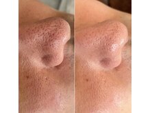 ヴィヴィエ 佐賀店(ViVier)の雰囲気（フォトギャラリーに症例写真やまつ毛パーマデザイン搭載してます）