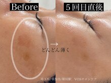 ソエル(Seul)の雰囲気(エステ専用アカウントInstagram【seul.masako_nara】)