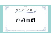 セルフケア整体 新宿店/ 当院で施術を受けられた方の例
