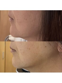 ビクト(Vict)/根本的な肌質改善は