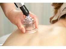 コルギ×カッピングで痩身効果も抜群！背中お腹の引き締めに◎