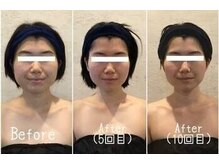 小顔フェイスラボ 名駅店(小顔 Face Labo.)の雰囲気（5回目からは無料で小顔矯正をプレゼント！骨格から小顔に改善♪）