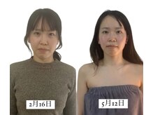 ルシエル/顎バランスからお顔を変える