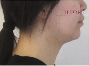 メディケア 新宿/元祖小顔トレーニング