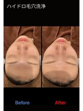 パリス デ スキン 岐阜マーサニジュウイチ店(Paris de skin)/【フェイシャル】Before/After