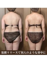 ルマ(Rumah)/血流を良くして代謝アップ