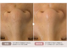 リッシュ 骨盤革命(RICHE.)/牛込神楽坂/韓国肌管理/美容整体