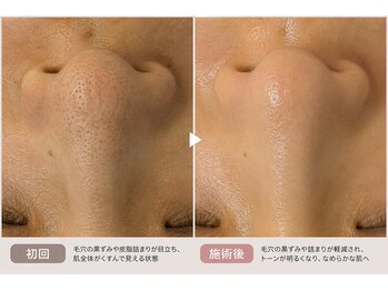 リッシュ 骨盤革命(RICHE.)/牛込神楽坂/韓国肌管理/美容整体